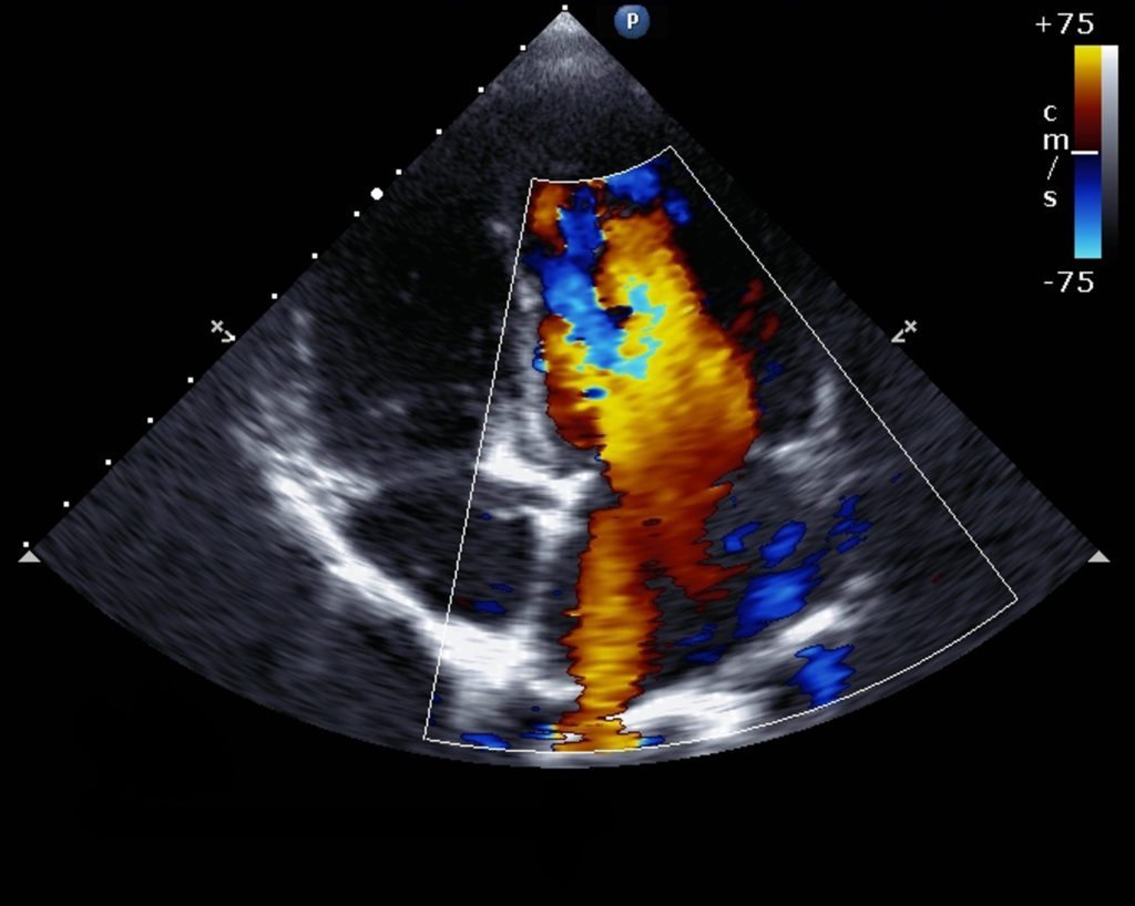 Echocardiography/Ultrasound Valentino Cardiology Specialists